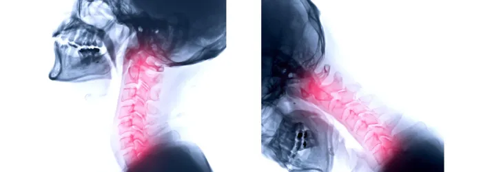 Chiropractic Lawrence Township NJ Pierce Results System 9